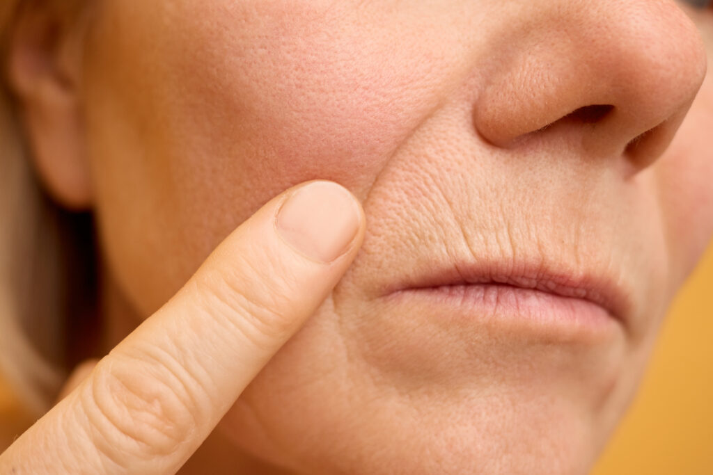 Close up of fine lines around the mouth showing early signs of skin ageing and collagen loss
