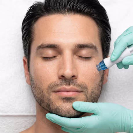 Man receiving a subtle facial aesthetic treatment, representing modern male aesthetic care and natural rejuvenation